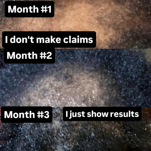 Bless Your Crown – Herbal, Scalp soothing Hair Rejuvenating Oil